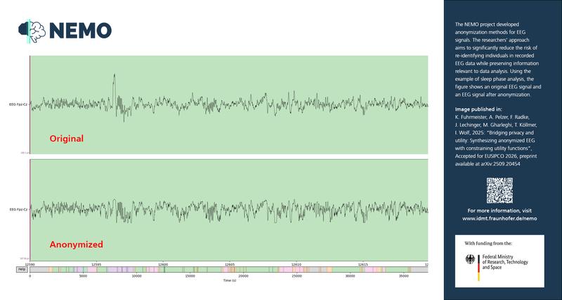Exemplarische Darstellung eines originalen (oben) und anonymisierten (unten) EEG-Signals aus einer Veröffentlichung im Rahmen des Projekts »NEMO«.