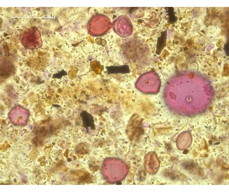 Aufbereitete Pollenprobe aus der Jungsteinzeit von den Sedimenten des Hüttwilersees. Pollenkörner sind rötlich eingefärbt. Holzkohleteilchen als Anzeichen für Brände erscheinen schwarz.
