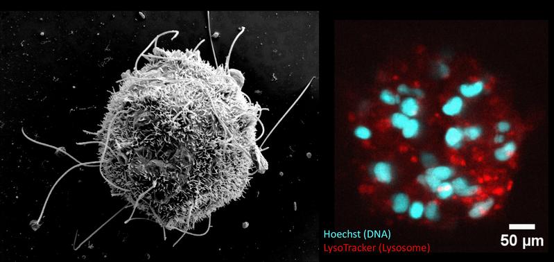 Images of a nematosome taken using a scanning electron microscope (left) and a confocal microscope (right). 