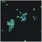 Die Abbildung (Quelle: AWI) zeigt ein Gemisch aus Zellen die mit einer universellen Sonde (blau) und mit einer Sonde für eine bestimmte Algengruppe (grün) angefärbt wurden.