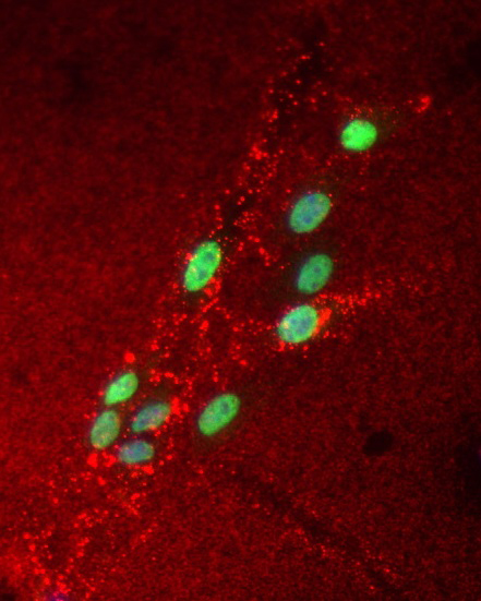 Immunofluoreszenz-Aufnahme von Mäusestammzellen, die Pax6 (grün) überexprimieren. Pax6 beeinflusst die Menge an alternativen Tenascin C-Formen (rot). 