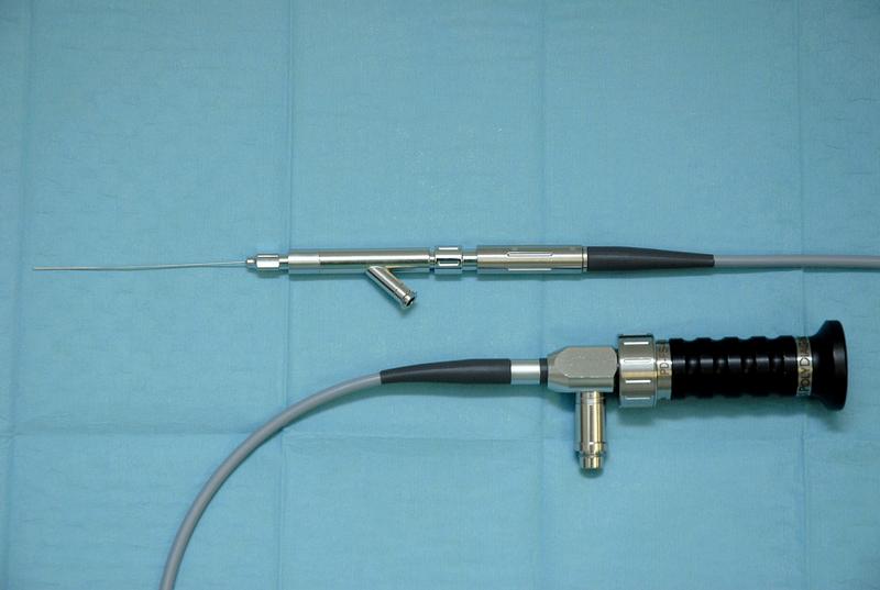 Bei der Duktoskopie kommt ein feinstes Endoskop von 1 bis 3 Millimeter Durchmesser zum Einsatz.