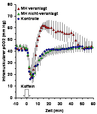 Bei Personen mit Veranlagung für die Maligne Hyperthermie (MH) verläuft die Kohlendioxid-Entwicklung im Oberschenkel nach einer Injektion von Koffein deutlich anders (Kurve mit roten Dreiecken) als bei gesunden Kontrollpersonen. Grafik: Anetseder