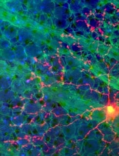 Multiquanten-mikroskopische Aufnahmen von "starburst"-Zellen mit Gewebe.