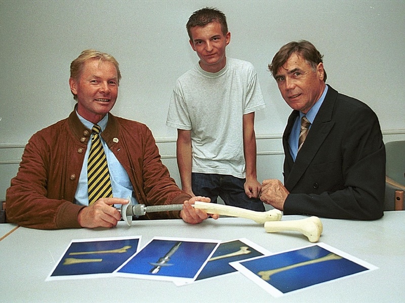 Dr. Karl Hermann Staubach (li.) und Dr. Hans Grundei mit Martin, dem ersten Träger der neuartigen Prothese. Sie betrachten Knochen und Metallschaft, der in den Oberschenkel implantiert wird.