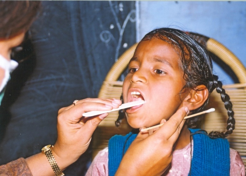 Rachenabstrich bei einer indischen Schülerin zum Nachweis von Streptokokken
