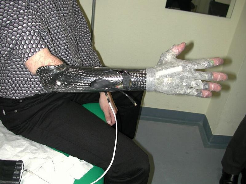 Prototyp einer neuen Prothesenhand mit Fluidaktoren. Noch sieht die Fluidhand aus wie eine Roboterhand, wird aber nach einer "kosmetischen" Behandlung bald kaum noch als künstlich zu erkennen sein.