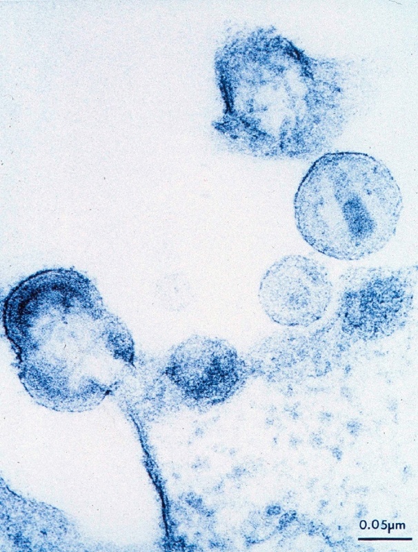 Neu gebildete HI-Viren schnüren sich von ihrer Wirtszelle ab. Um ihre Vermehrung zu behindern, muss auch untersucht werden, wie Medikamente zu Resistenzen führen. ©Universität Köln / Kaiser