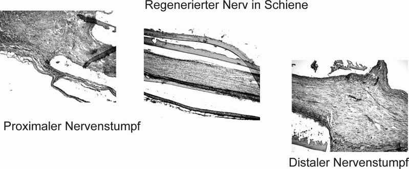 Schnittbild: proximaler (links) und distaler Nervenstumpf (rechts), dazwischen der regenerierte Nerv in der Schiene.
