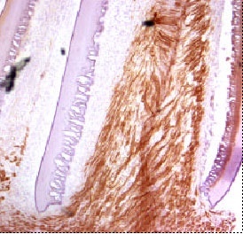 Distale Ansatzstelle eines regenerierten Ratten-Ischias-Nervs mit der Nervenschiene (blau). Fotos: alvito-biotech