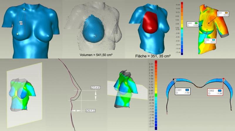 Unterschiedliche Messmethoden am Beispiel der Brustregion