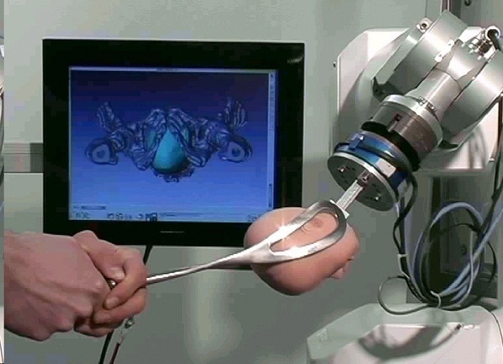 Am Geburtensimulator kann der Bediener einen kompletten Geburtsvorgang verfolgen und üben: zeitgleich an Phantom und Bildschirm