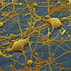 Abb.: Elektronenmikroskopische Aufnahme eines Netzwerks von Nervenzellen. Copyright: Jürgen Berger, Max-Planck-Institut für Entwicklungsbiologie, Tübingen
