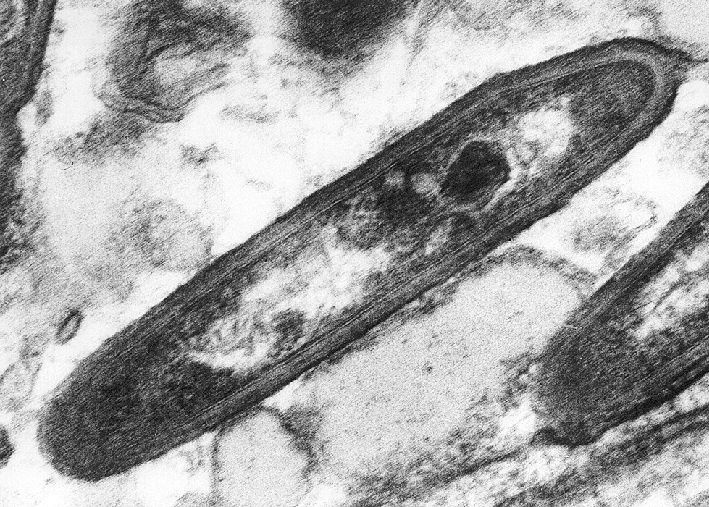 Stäbchenförmiges Whipple-Bakterium (Tropheryma whippelii) / Elektronenmikroskopisches Bild