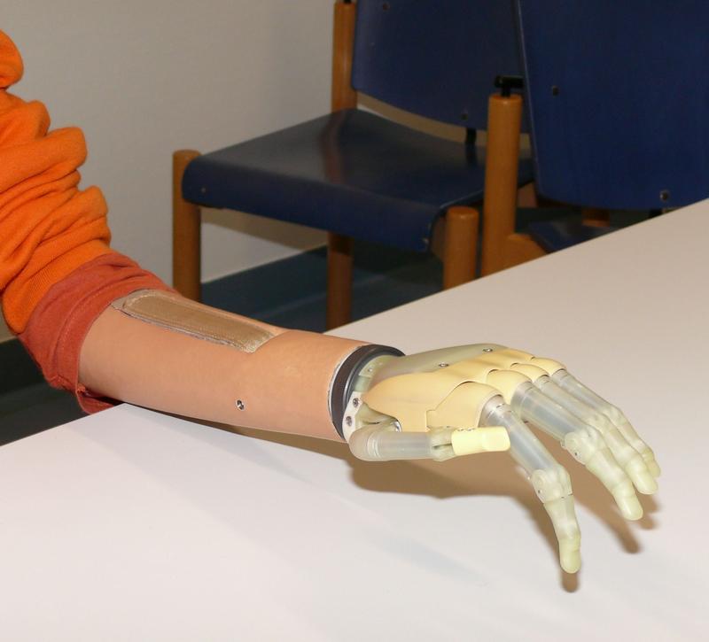 Die Prothesenhand "i-Limb" der schottischen Firma "Touch Bionics".