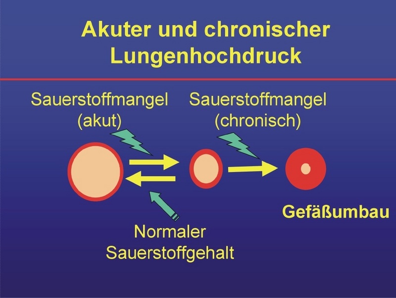 Schematische Darstellung von Gefäßquerschnitten des Lungenkreislaufs (Ausführliche Bildunterschriften siehe oben)