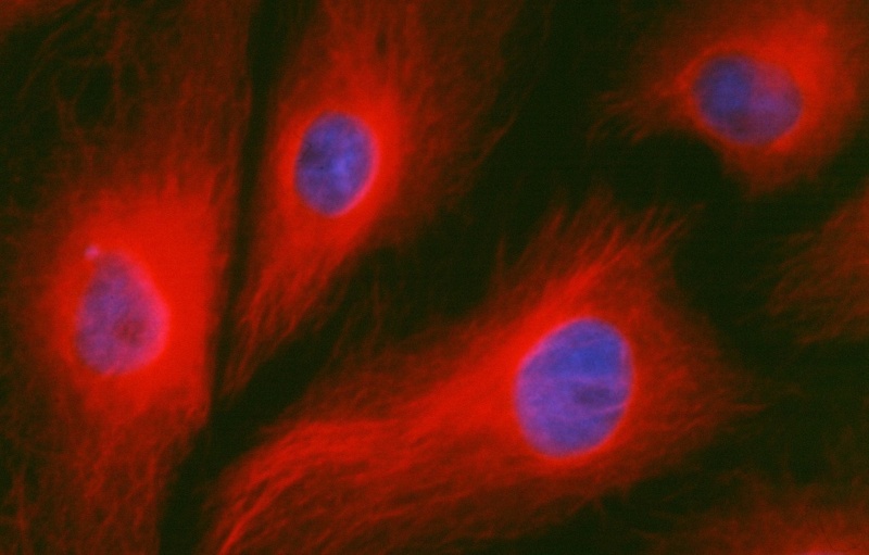 Mit einem roten Fluoreszenzfarbstoff werden Mikrotubuli kultivierter Zellen der Beutelratte sichtbar gemacht. Deutlich zu erkennen sind die fädigen Strukturen. Die Zellkerne wurden blau angefärbt.