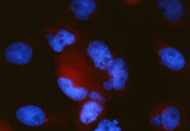 Eine Zugabe von Tubulysin A zu den Zellen führt zu einem Abbau der Mikrotubuli. Nach acht Stunden sind keine fädigen Strukturen mehr zu erkennen. Dafür werden die Ursprungsorte der Mikrotubuli, die Centrosomen, als leuchtende Flecken sichtbar.