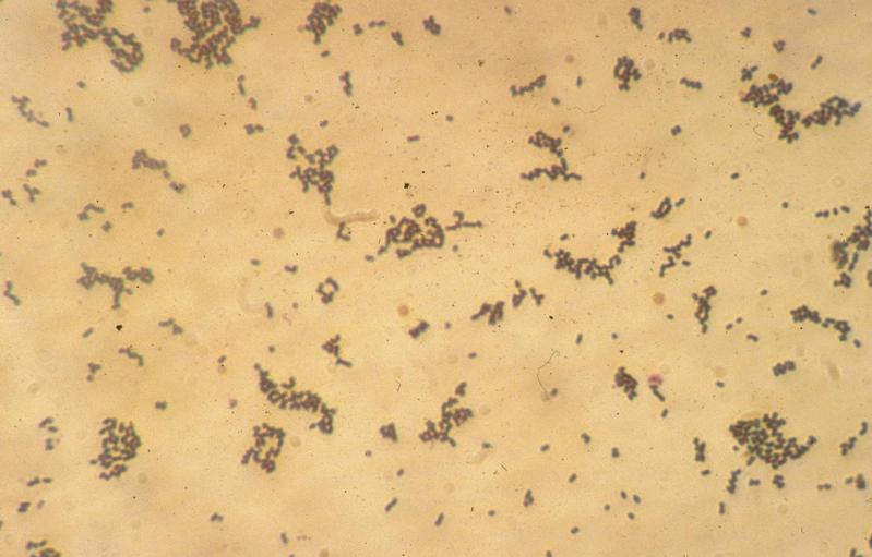 Lichtmikroskopische Darstellung von Listeria monocytogenes (Vergrößerung 1000-fach, Färbung nach Gram)