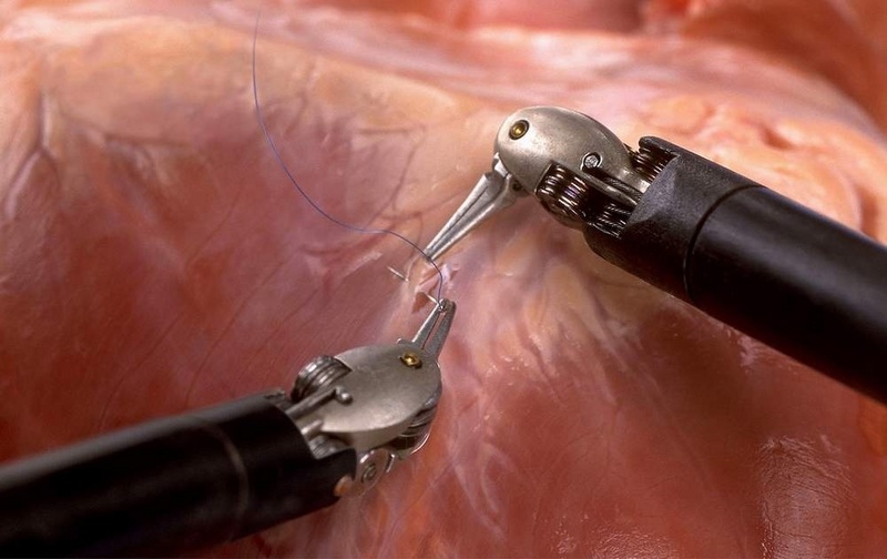 Die beiden Roboterarme, mit feinen Geräten bestückt, ermöglichen ein präzises Operieren / Foto: Intuitive Surgical.