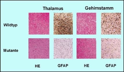 Mit Prionen infizierte Wildtyp-Mäuse zeigen schwammartige Veränderungen im Gehirn (HE-Färbung) und Aktivierung von Gliazellen (GFAP-Färbung). Beide Veränderungen fehlen bei Mutanten, deren Prion-Protein verändert ist. Grafik: Flechsig