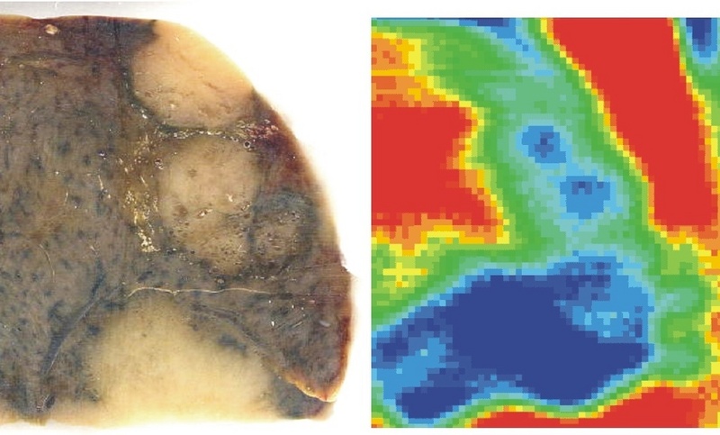 Links: histologisches Präparat einer menschlichen Leber mit Metastasen (40x50mm). Rechts: THz-Transmissionsbild (f=0,23THz), neben Tumoren (blau) sind zusätzliche Strukturen erkennbar