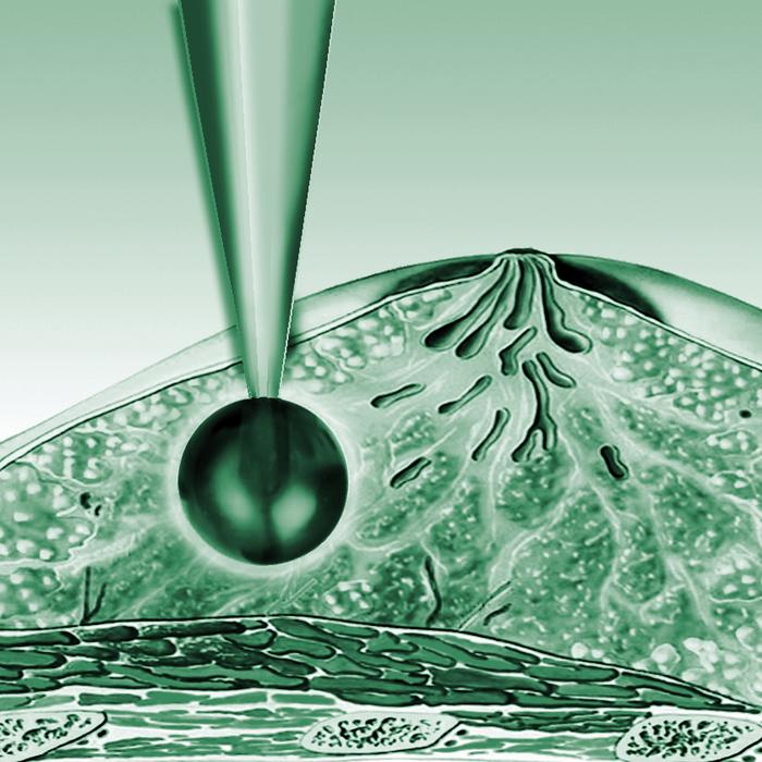 Intrabeam-Applikator