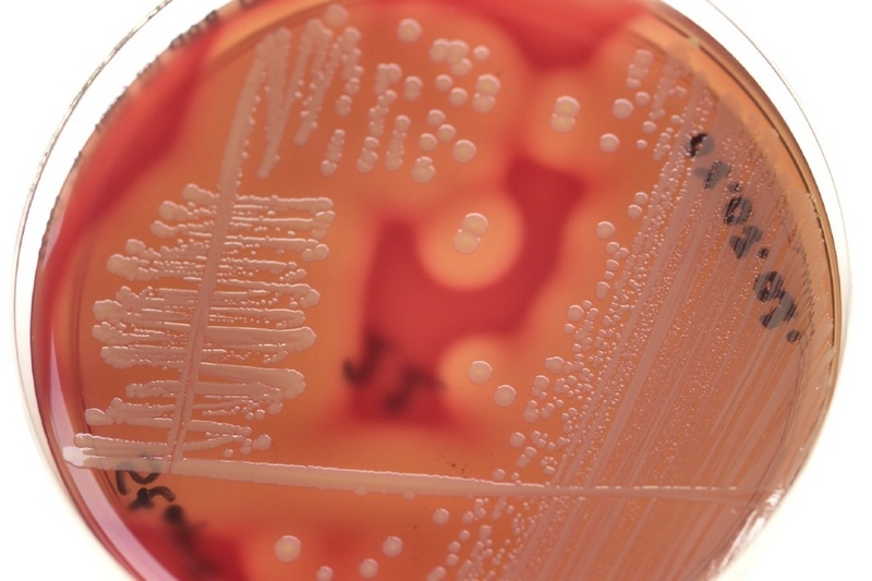 Hält fast allen Antibiotika stand: Bakterienkultur mit multiresistentem Staphylococcus aureus (MRSA). / Foto: Medienzentrum Universitätsklinikum Heidelberg.