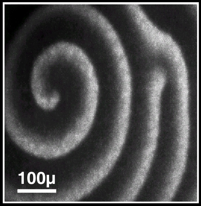 Kalziumwelle als Spiralmuster in einer Frosch-Eizelle. Aufnahme von P. Camacho und J.D. Lechleiter, University of Texas, San Antonio.