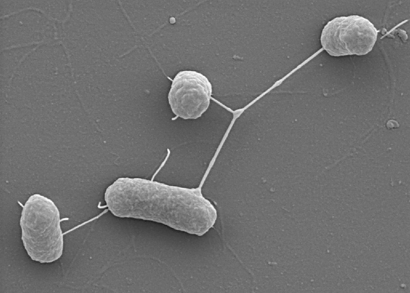 Elektronenmikroskopische Aufnahme von EHEC vom O157:H7 Serotyp, Foto: Rohde (GBF)