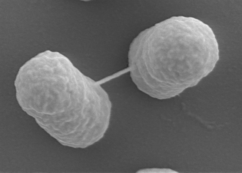 Elektronenmikroskopische Aufnahme eines EHEC vom O26:H11 Serotyp, Foto: Rohde (GBF)