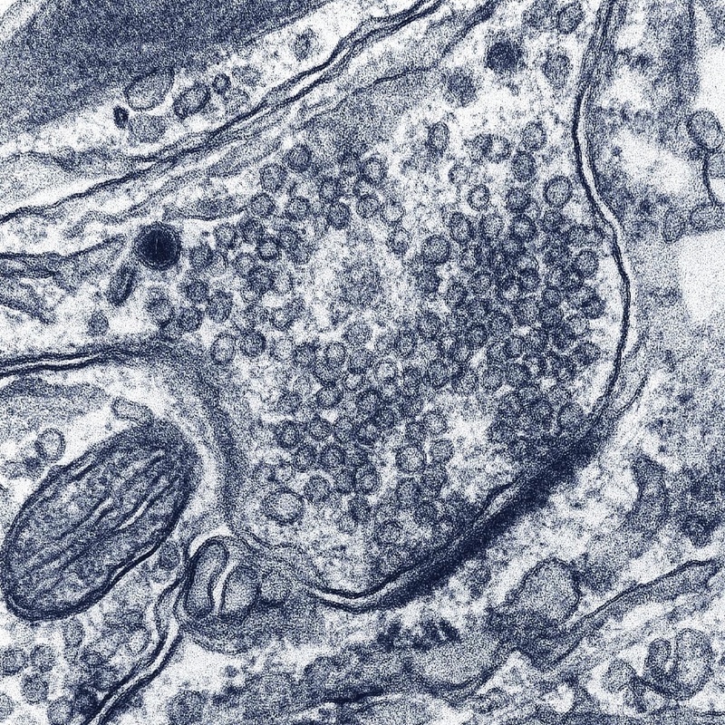 Elektronenmikroskopische Aufnahme einer Synapse zwischen hippokampalen Zellen in Kultur. Der "Vorrat" an synaptischen Vesikeln ist deutlich zu sehen. (Abb: Jürgen Klingauf, Max-Planck-Institut für biophysikalische  Chemie)