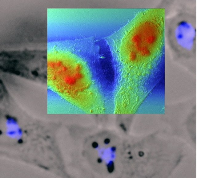 Multimodale Microscopy of cells: AFM fast contrast and fluorescence 