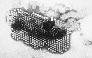 Elektronenmikroskopische Aufnahme eines Coxsackie-B3-Virus in 120.000facher Vergrößerung. Foto: Institut für Virologie des Uniklinikums Jena