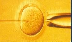 Intrazytoplasmatische Spermieninjektion (ICSI)