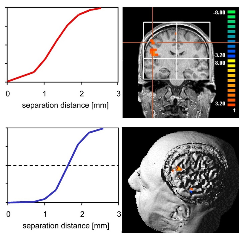 f-MRI-Ansichten ins Gehirn, die die Orte maximaler Aktivitätsänderung aufgrund von Lernvorgängen im Bereich der Fingerrepräsentation zeigen. Die Aktivitätsänderung bewirkt, dass kleinere Abstände (rote Kurve) ertastet werden können als vor dem Lernen