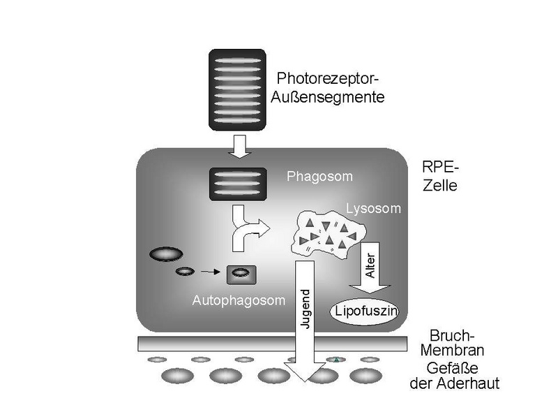 Das retinale Pigmentepithel (RPE) baut die sich ständig erneuernden Membranscheibchen (Außensegmente) der Photorezeptoren (Lichtsinneszellen) ab. Im Alter werden unverdauliche Proteine als Lipofuszin abgelagert; die Netzhaut wird dadurch zerstört.