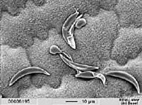 Infektionsstrukturen des pflanzenpathogenen Pilzes