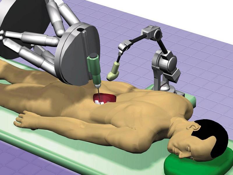 Bei Wirbelsäulenoperationen kann der neue Operationsroboter die Pedikelschrauben exakt positionieren und eindrehen.