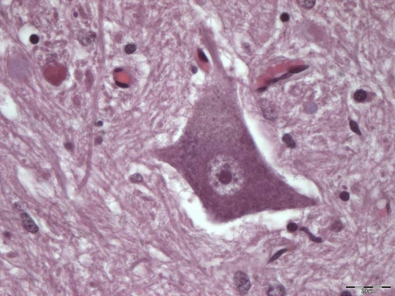 Mikroskopischer Querschnitt durch das gesunde Rückenmark des Menschen. In der Mitte ein Motoneuron, der Zelltyp, der bei SMA-Patienten zu Grunde geht und dadurch die Erkrankung auslöst. Foto: Lehrstuhl