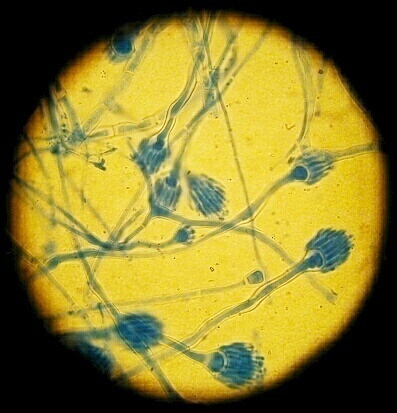 Vertreter des Pinselschimmels Penicillium: Sie können sowohl Penicillin bilden als auch Lebensmittel verderben