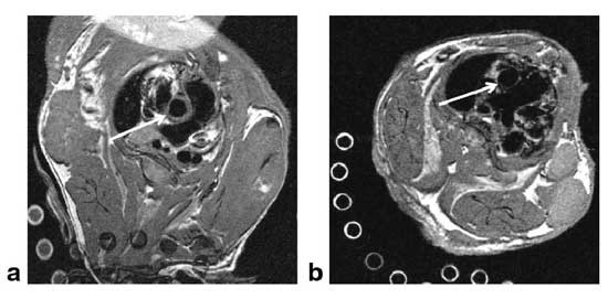Der Pfeil im Bild rechts zeigt bei einer gesunden Maus auf die Aorta, die so zart ist, dass sie im MR-Bild kaum erscheint. Dagegen ist die Wand der Aorta links massiv verdickt - ein Hinweis auf eine schwere Arteriosklerose. Aufnahmen: Wiesmann