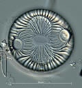 Diatomee (Auliscus), Foto: Friedel Hinz, Alfred-Wegener-Institut