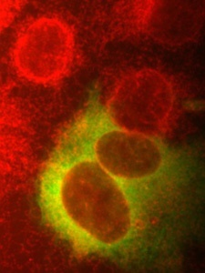 Das rote Geflecht (Endoplasmatisches Retikulum) rund um die dunkleren, ovalen Zellkerne enthält auch das neu entdeckte VKOR-Protein. Die grüne Farbe zeigt ein anderes Protein an, das gleichmäßig in der Zelle verteilt ist. Aufnahme: Simone Rost