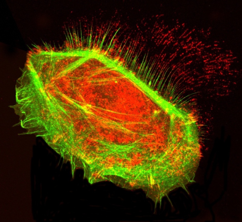 Hautzelle des Menschen, die auf einer Glasoberfläche gewandert ist. Rot gefärbt sind Oberflächenproteine (Integrine), das Zell-"Skelett" aus stabilisierenden Proteinfasern leuchtet grün. Foto: Dr. Kirfel