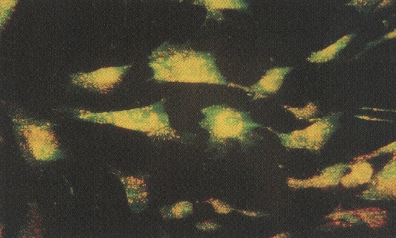Endothelzelle nach Inkubation mit Acridin Orange bei konventioneller Fluoreszenzmikroskopie.