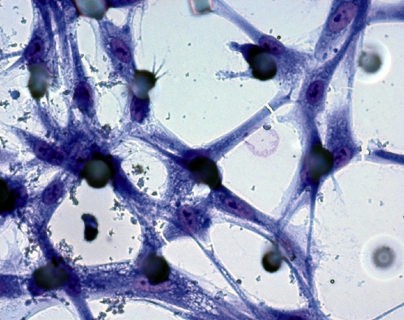 Zellen orientieren sich beim Wachsen am Untergrund: Die Säulenstruktur der Silikon-Oberfläche beeinflusst hier die Morphologie humaner Bindegewebszellen, der Fibroblasten. © Fraunhofer