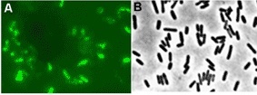 Mikroskopische Aufnahme neuartiger sulfatreduzierender Bakterien