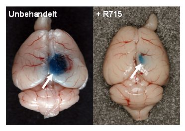Unbehandelte Mäuse (links) entwickeln nach Schädel-Hirn-Trauma ein rel. ausgeprägtes Hirnödem (blaue Färbung, weißer Pfeil). Durch Behandlung mit dem Bradykinin-1-Rezeptor Blocker R715 kann die Hirnödementstehung massiv unterdrückt werden (rechts).