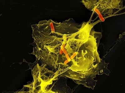 Abb. 1: Stimulierte Neutrophile mit Netzen und darin gefangenen Shigellen (orange). Farbige rasterelektronenmikroskopische Aufnahme. Bild: Max-Planck-Institut für Infektionsbiologie